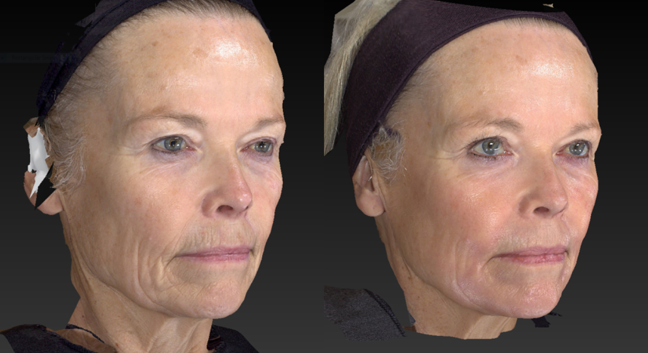 Clinic805-Before-After-Pearl-1-2