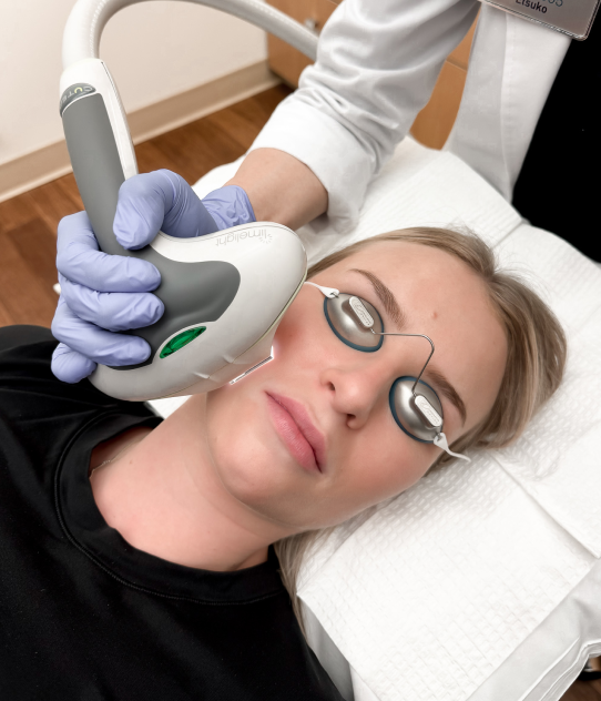 Clinic-805-Victoria-IPL-Photofacial
