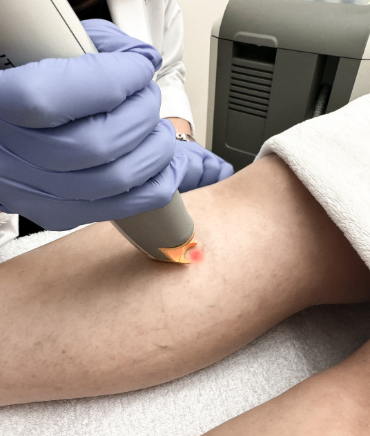 Clinic-805-Victoria-Laser-Treatment-Leg-Veins-Updated